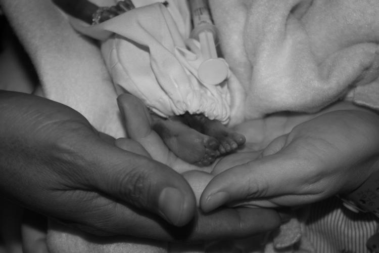 Madisela's tiny feet
